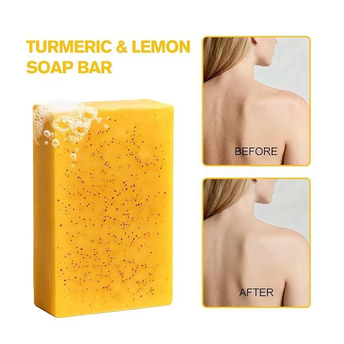 Kojic Acid Soap, Turmeric Soap Bar for Dark Spot Removal, Natural Turmeric Handmade Soaps for Face and Body, Organic Use Skin Care Soaps, Deep Cleans the Skin and Provides More Moisturizing (2Pcs)