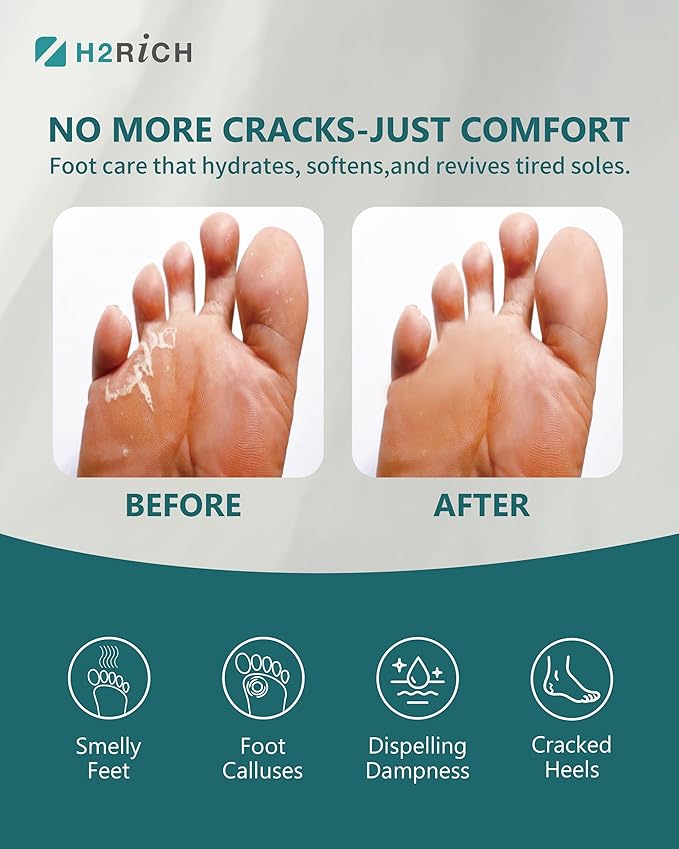 Hydrogen Foot Soak Effervescent Tablets 10 Pack | Ginger & Mugwort Herb Foot Bath, Relaxing Spa Pedicure Care | Improves Circulation, Soothes Tired Feet, Softens Calluses, Controls Odor