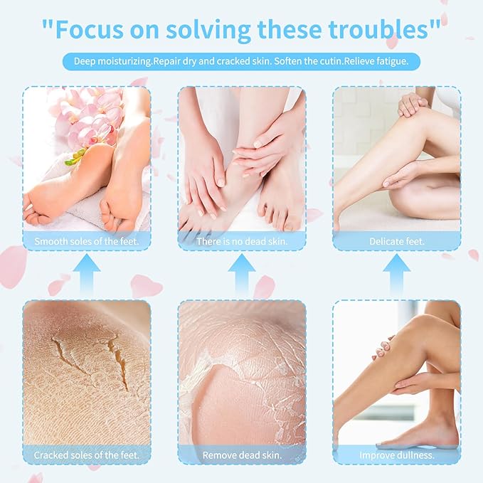 Gel Socks for Dry Cracked Feet Women,Foot Moisturizing Socks,Gel Socks Spa Socks,Cotton Socks for Moisturizing Feet Overnight
