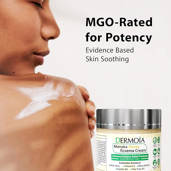 Manuka Honey Cream - Eczema Cream for Adults & Kids - Seborrheic Dermatitis Cream for All Skin Types - Eczema Honey Cream for Redness & Itch Skin Relief with Aloe Vera - 4oz