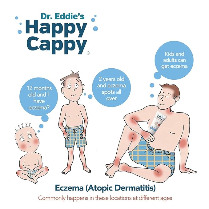 Happy Cappy Medicated and Daily Shampoo and Beanie Brush Bundle - Baby Dandruff Shampoo, Cradle Cap Brush for Babies, Toddlers, Helps Cradle Cap and Seborrheic Dermatitis, Fragrance-Free - 3 Pieces