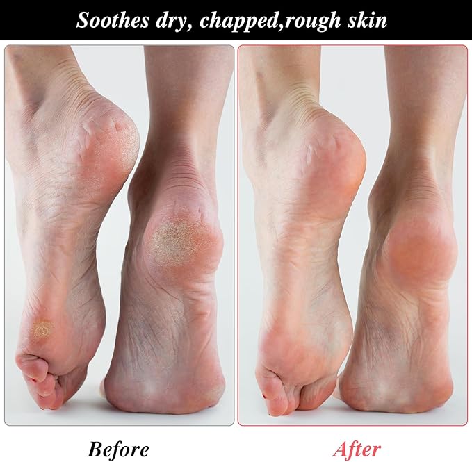 3 Pairs Foot Moisturiser Socks Overnight, Spa Cotton Socks for Foot Cream, Lotion Sock for Moisturising for Dry Feet Care, Moisturising Sock for Cracked Heel Repair Women Men (Pink)