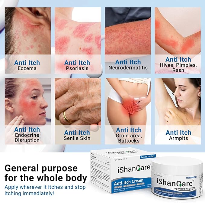 ishancare Anti Itch Cream Extra Strength, Oatmeal Soothing Skin Itch Relief Ointment for Rash, Dermatitis, Eczema, Psoriasis, Hives, Sun, Bites, Poison Ivy, Large Can 3.5 oz