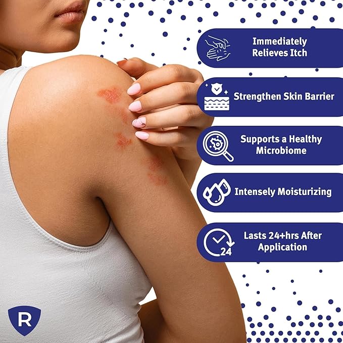 Eczema Relief Cream | Clinical-Strength Itch Relief & Dermatitis Treatment for Adults, Baby and Kids | Advanced Eczema Therapy and Skin Barrier Repair, Colloidal Oatmeal for Itchy Skin | 2 Fl Oz