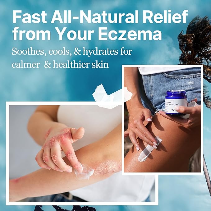 The Ocean Healed My Eczema Natural & Soothing Eczema Cream - Hydrating & Nourishing Psoriasis Cream with Sea Moss & Colloidal Oatmeal - Quick Absorbing Anti Itch for Dry Sensitive Skin (4oz)