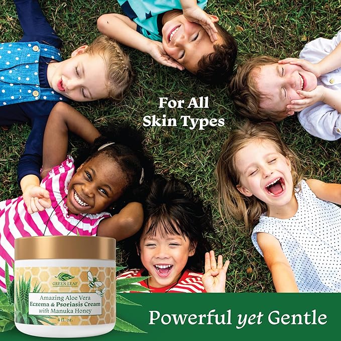 Manuka Honey Eczema Cream Moisturizing Lotion Fragrance Free For Psoriasis Relief - Itchy, Dry Skin Rash Ointment - Skin Soothing Moisturizer - Body & Face Cream - Kids & Adults 8oz